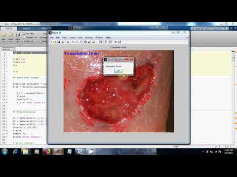 Foot Ulcer Detection and Classification | Image Processing Projects | MATLAB