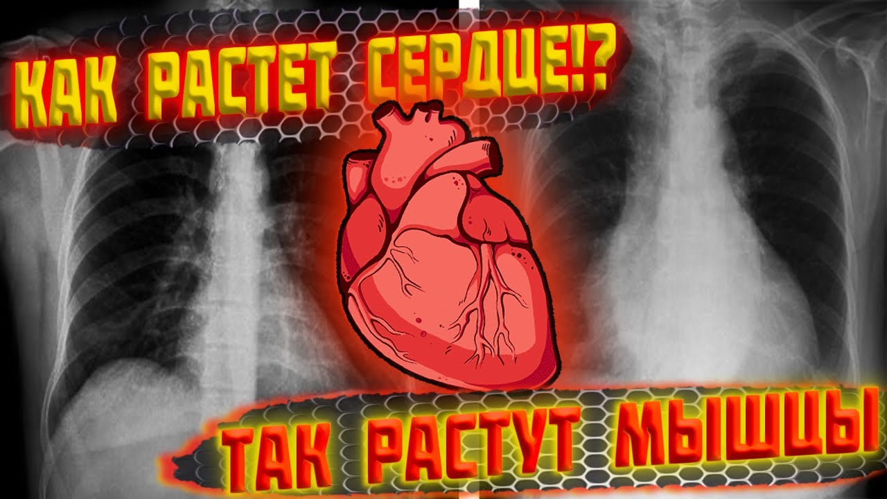 Как растет сердце!? Так растут мышцы... - YouTube