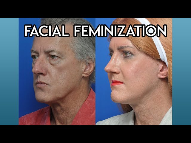 Facial Feminization