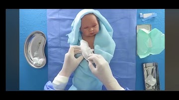 ATENCIÓN INMEDIATA DEL RECIÉN NACIDO