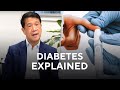 Diabetes explained | Professor Roger Chen