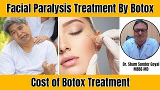 Facial Paralysis Treatment by Botox | Cost of Botox