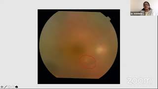 AIOC2021-IC487-Topic-Dr.MANISHA AGARWAL