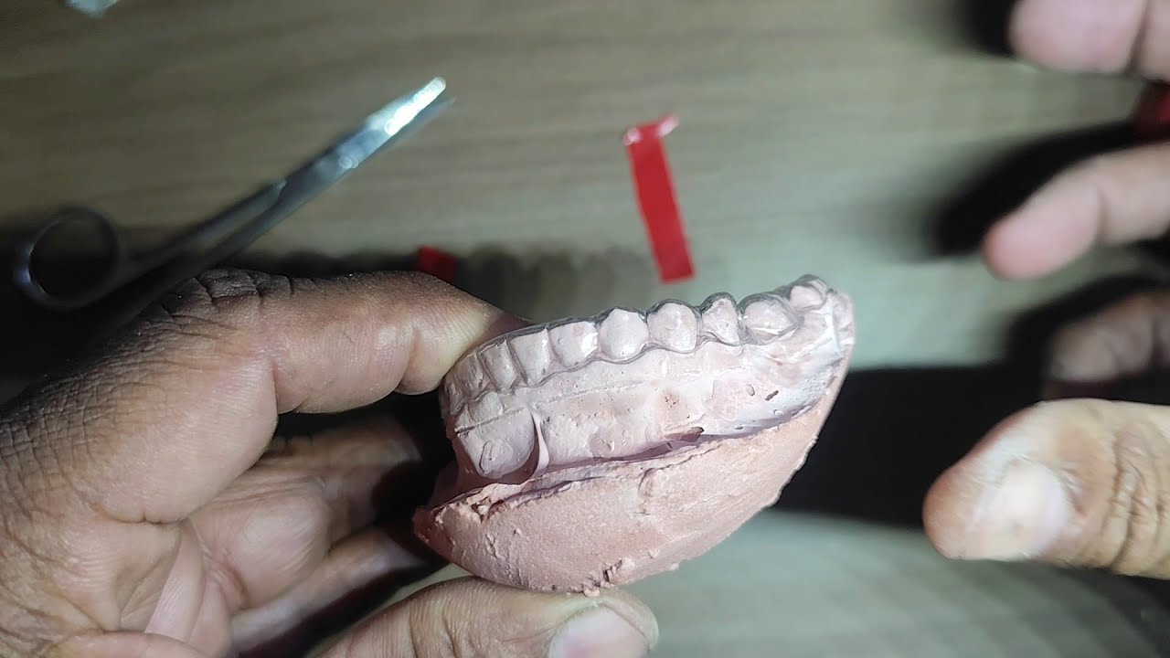 PLACA EM ACETATO - MACETE DE LABORATÓRIO - EM HD