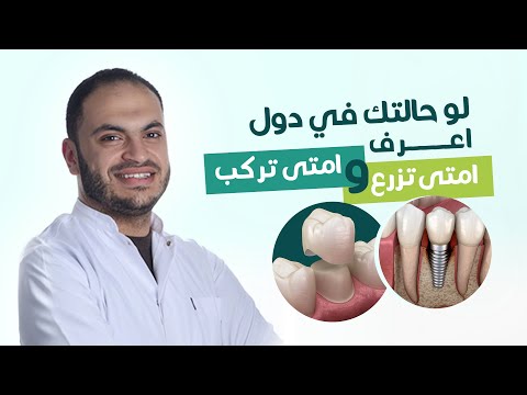 ايه الفرق بين زراعة الاسنان وتركيبات الاسنان د أحمد العايدي