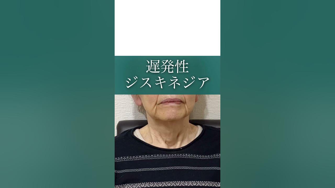 ジスキネジア 遅発性ジスキネジア 口唇ジスキネジア YouTube