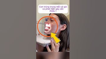 [P.1] Con trùng trong mũi cô gái và phát hiện gây sốc #shorts