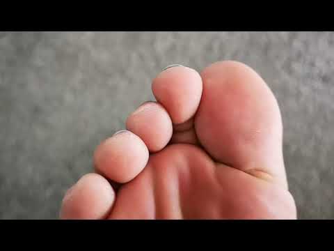 Sweaty Soft Sole Close Up