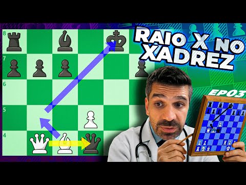 Are you a beginner? Basic Chess WORKS! - SleepRun S07E003