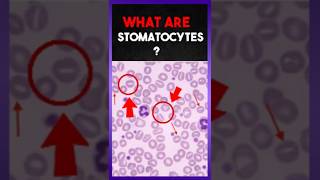 What Are  Stomatocytes  ? 🩸 | Clear Explain