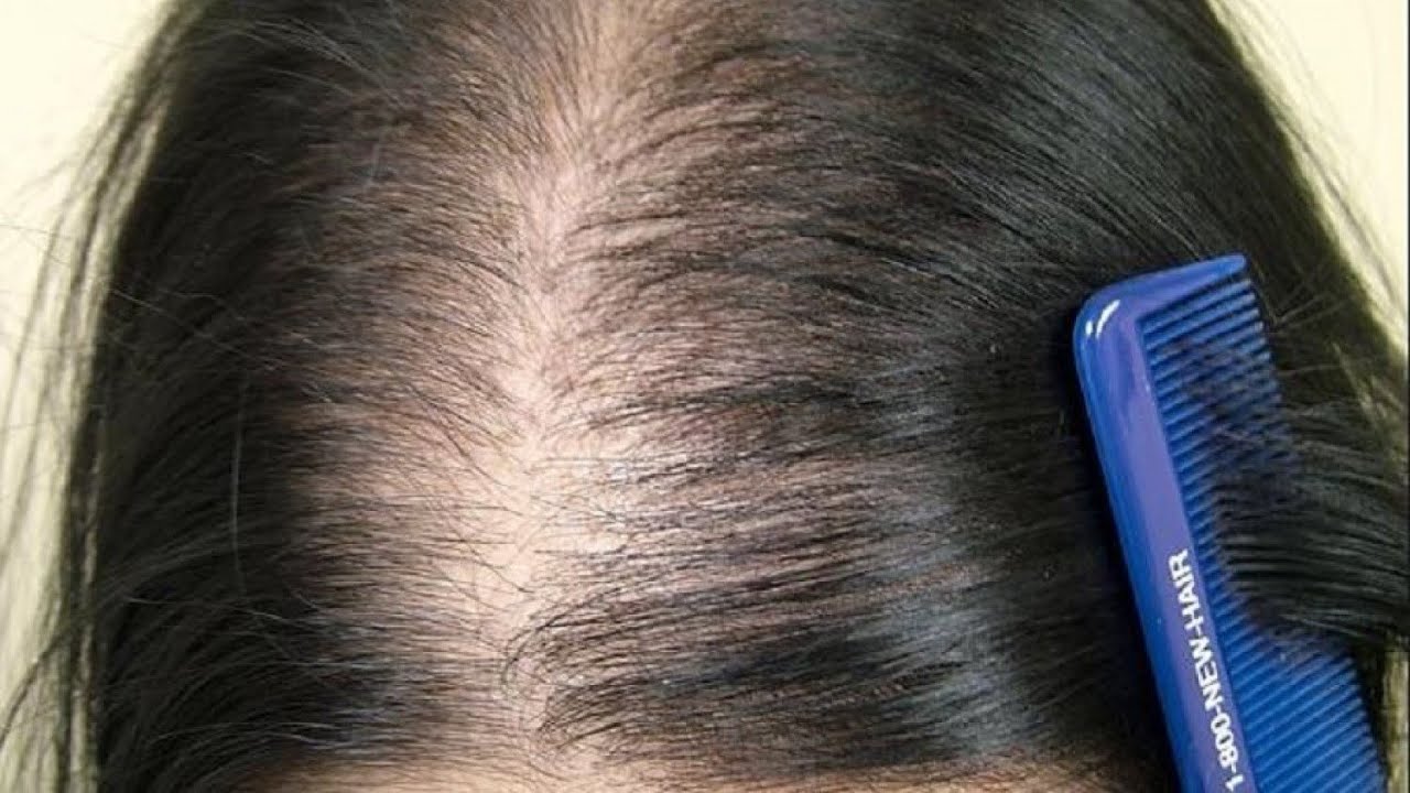 خزان الحديد وعلاقته بالشعر.. كيفية ملئ الخزان مع وصفة جد فعالة في اخر الفيديو