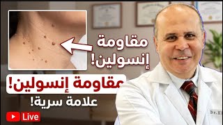 تخلص من الزوائد الجلدية بسرعة! أفضل طريقة طبيعية وآمنة