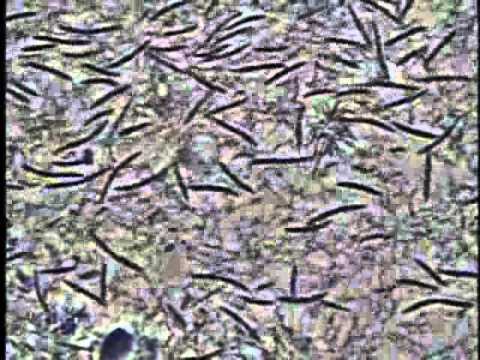 スピロヘーター YouTube