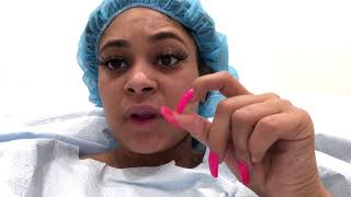 My Bbl Journey Preopday1