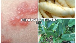 PENAWAR KAYAP API | ubi benban #ubatkayap #penyakitkulit