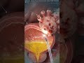 Bladder cancer warning signs explained 🚨 Realistic cystoscopy &amp; 3D medical animation. Ai generated