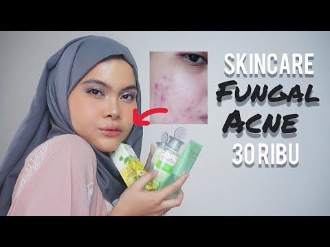 Hallo, assalamualaikum. Aku Zahwa Fitria, di video kali ini aku ngasih rekomendasi facial wash untuk. 