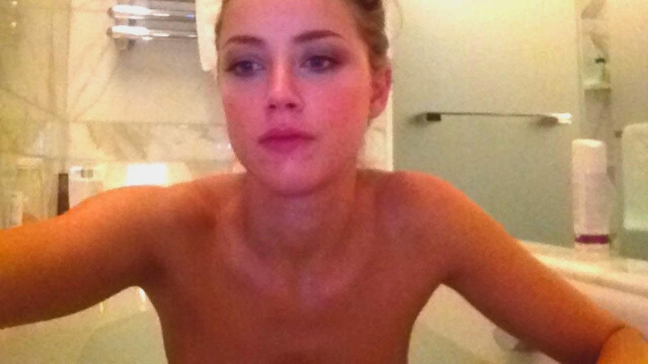 New pictures show Amber Heard's 'bruised face' after Johnny Depp 'threw phone