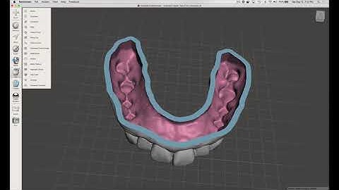 3D Printing Part 2 - Learning Meshmixer to Base a Dental Model