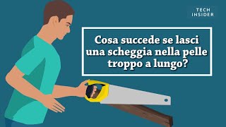 Ecco Cosa Succede Se Lasci Una Scheggia Nella Tua Pelle Troppo A Lungo Insider Italiano