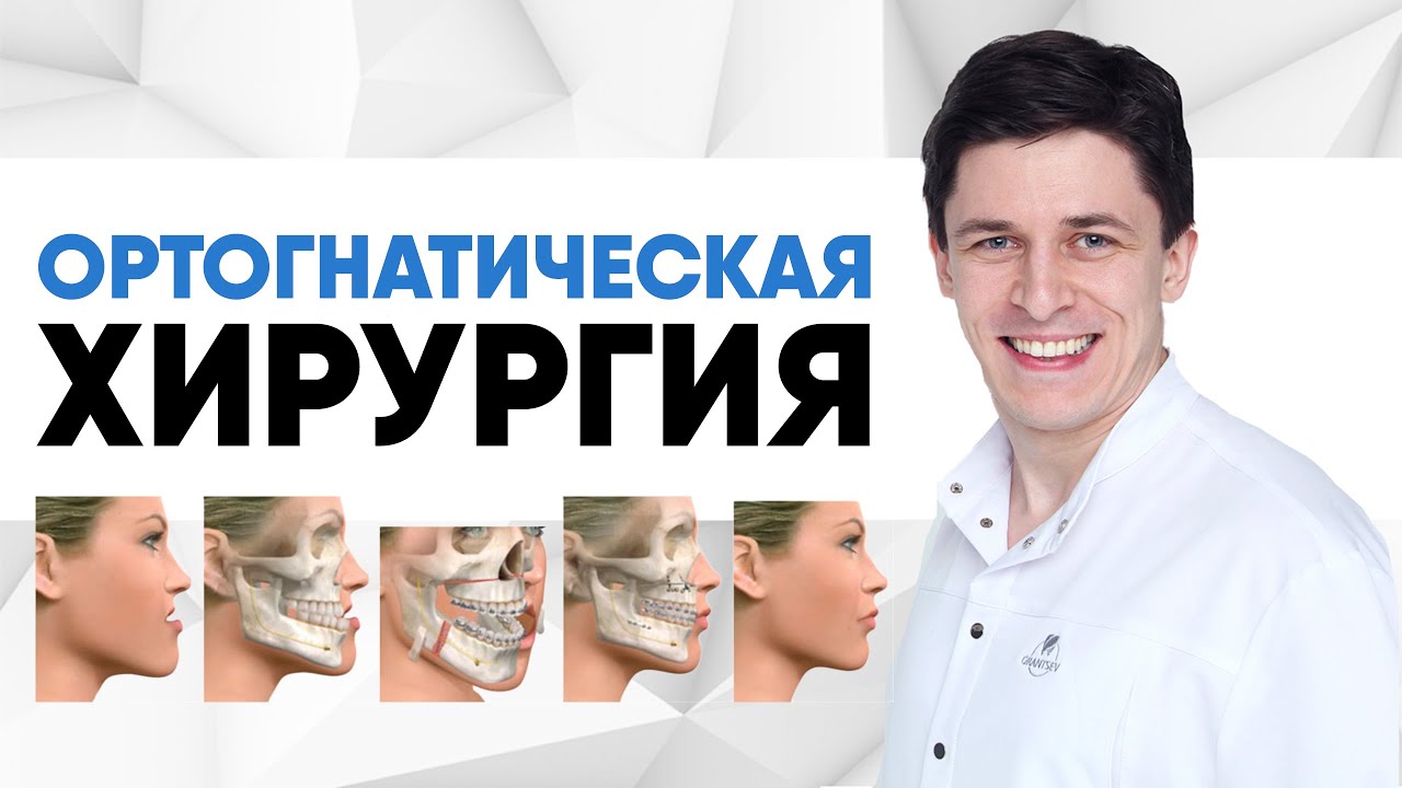 Ортогнатическая хирургия для ортодонтического лечения.