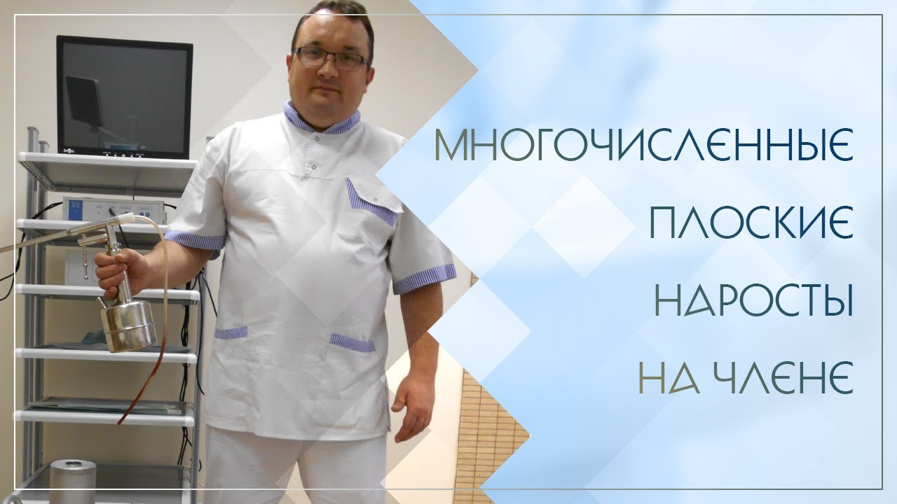 😲 Многочисленные плоские наросты на члене. Клинический случай №95 - YouTube