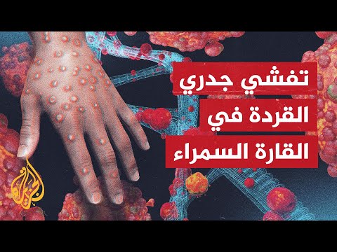 الاتحاد الإفريقي يعلن حالة طوارئ صحية إثر تفشي جدري القردة