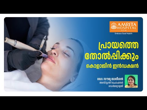 മൈക്രോ നീഡിലിംഗ് റേഡിയോ ഫ്രീക്വൻസി ചർമ്മത്തിൽ സൃഷ്ടിക്കുന്ന മാജിക്ക്