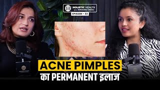 What Causes Acne and How You can Prevent it | Best Diet For Pimple (Acne) Free Skin | Shivangi Desai