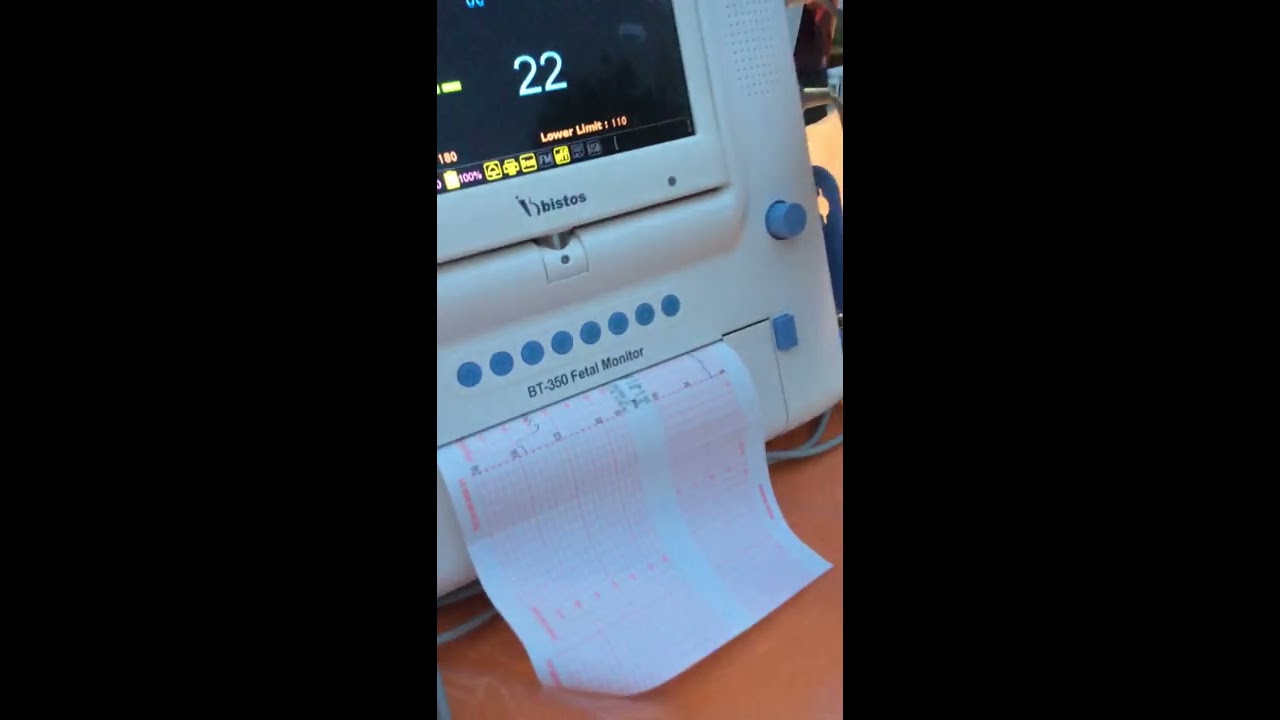The Bistos 350 FETAL MONITOR
