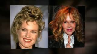 Melanie Griffith Plastic Surgery
