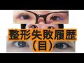 自分の整形失敗歴を語る 60万金ドブ。Talking About My Plastic Surgery Failures - $6,000 Down the Drain