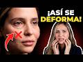 Por Qué NUNCA Debes Rellenar Arrugas En Tu Rejuvenecimiento Facial