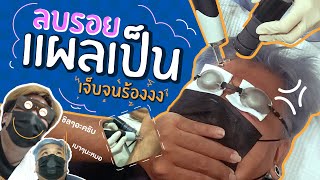 แผลในใจลบไม่ออก แต่แผลเป็นลบได้ | คนพันธุ์เสือ EP.91 | SHOCKER BOYS