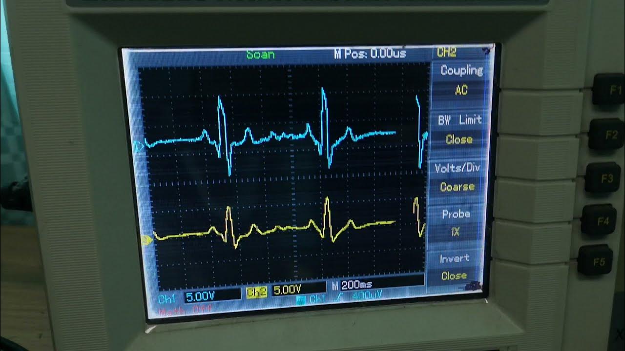 Measure ment the ECG signal using Oscilloscope and Sound card YouTube