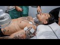 I Tried Acupuncture For The First Time With Brandon William