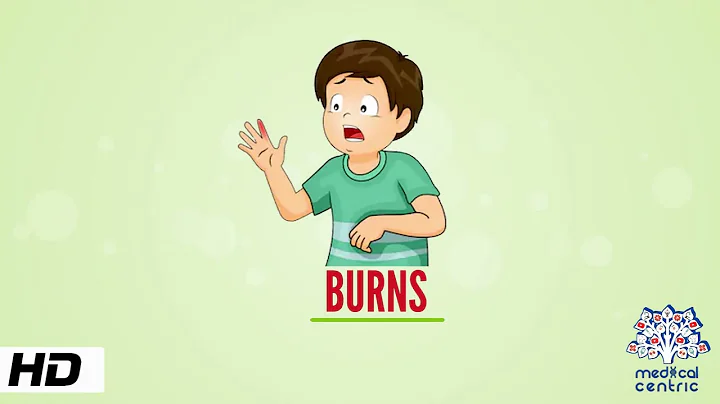 Burns, Causes, Signs and Symptoms, Diagnosis and Treatment.