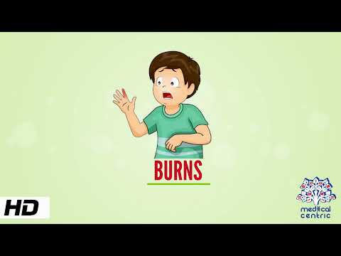 Burns, Causes, Signs and Symptoms, Diagnosis and Treatment.