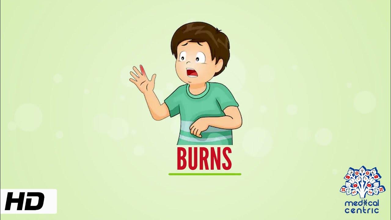 Burns, Causes, Signs and Symptoms, Diagnosis and Treatment. YouTube