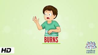 Burns, Causes, Signs and Symptoms, Diagnosis and Treatment.