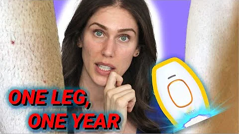 I Shot Intense Pulsed Light Into My Leg For 1 Year...