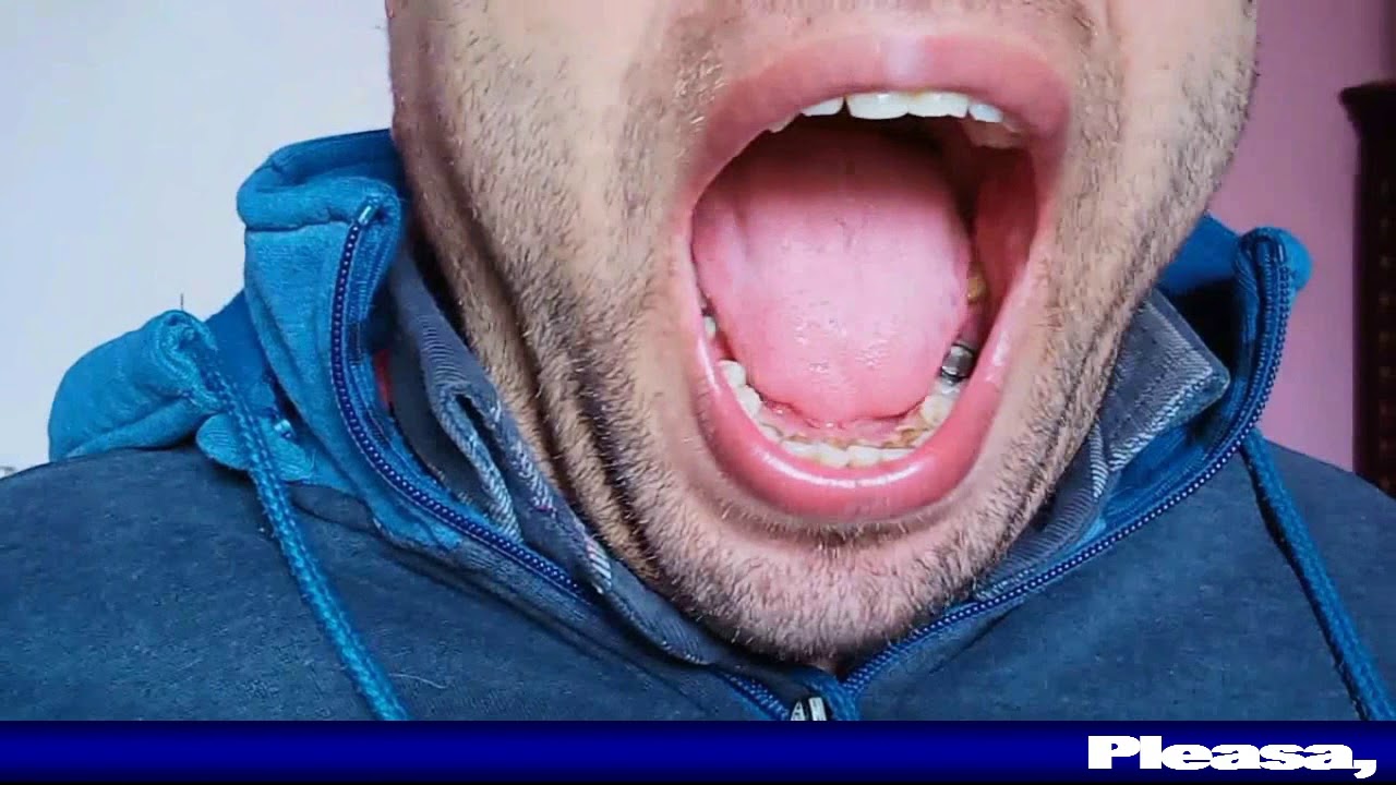 9 تمارين لتقوية عضلات اللسان لمريض الجلطة ومشكلة الكلام