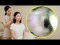Ear Care Tutorial | Safe and Educational