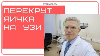 Перекрут яичка на УЗИ мошонки