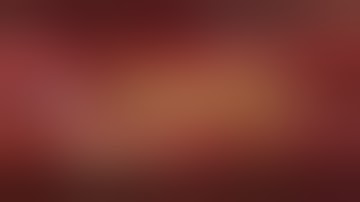 Rotational Atherectomy for Peripheral Artery Disease | CardioVisual