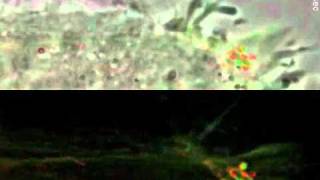 Entrapment of Intracytosolic Bacteria by Septin Cage-like Structures