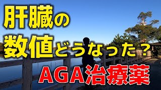 【治療15カ月】AGA治療薬で肝臓の数値はどうなってる？【ハゲダス注意報】