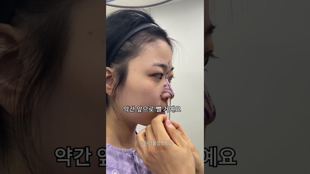 [Вондерфул гоо сайхны мэс заслын эмнэлэг] Нүд, хамрын мэс засал хийлгээд айдол боллоо!