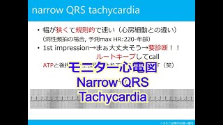 【モニター心電図】極論と独断で語るモニター心電図　第４話　よくわからない頻拍は、Narrow QRS Tachycardiaでまとめたは？