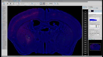Webinar: Performing Brain-Wide Measurements and Mapping them NeuroInfo and BrainMaker